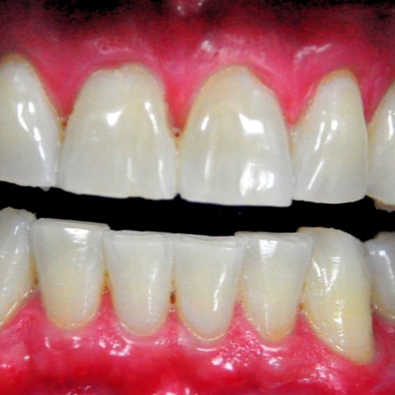 case 3 post - Edited